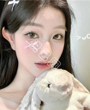 【小笨鱼】的相册