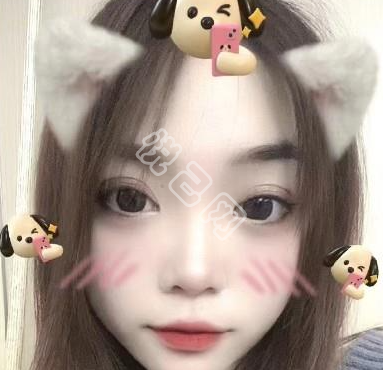 【雾里看花】的相册